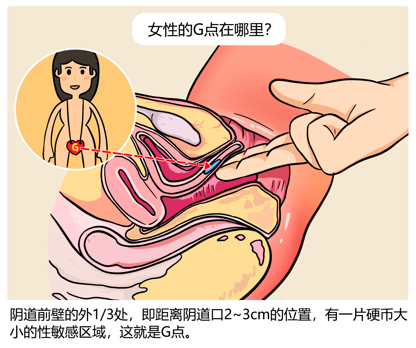 女生到底有没有G点呢？